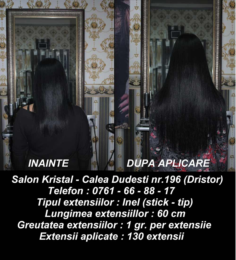 Aplicare Extensii Par Natural In Bucuresti